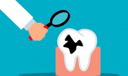 【夢占い】腐った歯の夢の意味 11 選