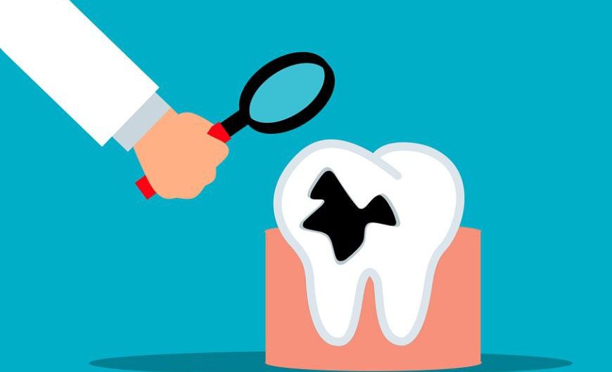 【夢占い】腐った歯の夢の意味 11 選