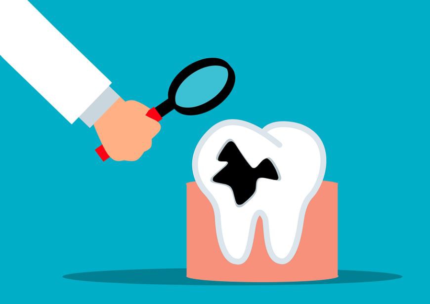 【夢占い】腐った歯の夢の意味 11 選