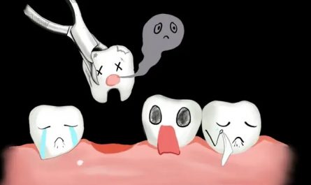 【夢占い】歯医者で歯を抜く夢の意味 16 選