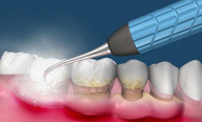 【夢占い】歯を掃除する夢の意味 12 選