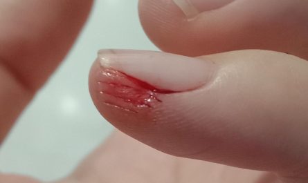 【夢占い】手を怪我する夢の意味 22 選