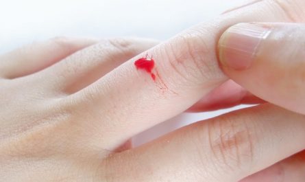 【夢占い】指から血を流す夢の意味 18 選