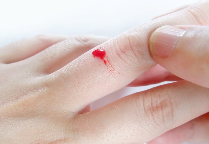 【夢占い】指から血を流す夢の意味 18 選