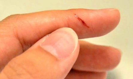 【夢占い】指を切る夢の意味 14 選