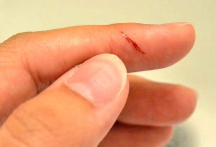 【夢占い】指を切る夢の意味 14 選