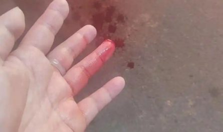 【夢占い】指を切られる夢の意味 30 選