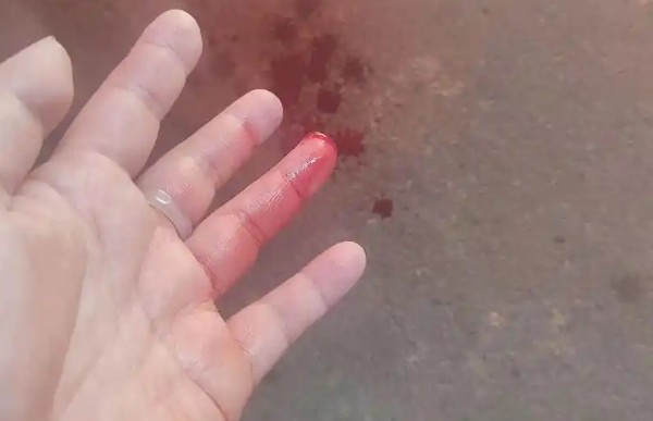 【夢占い】指を切られる夢の意味 30 選