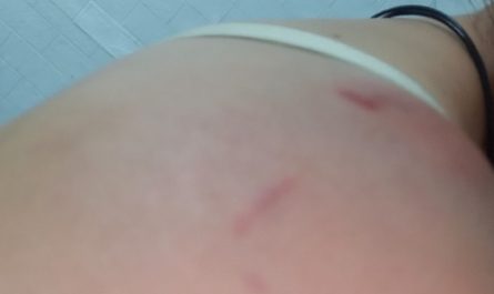 【夢占い】夫に殴られる夢の意味 11 選