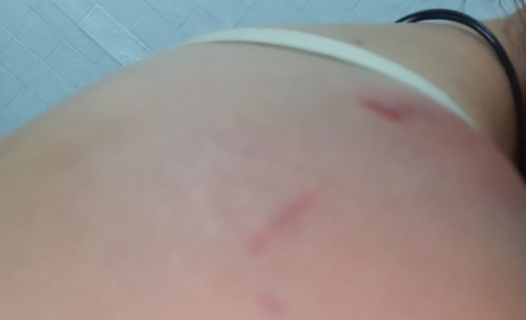 【夢占い】夫に殴られる夢の意味 11 選